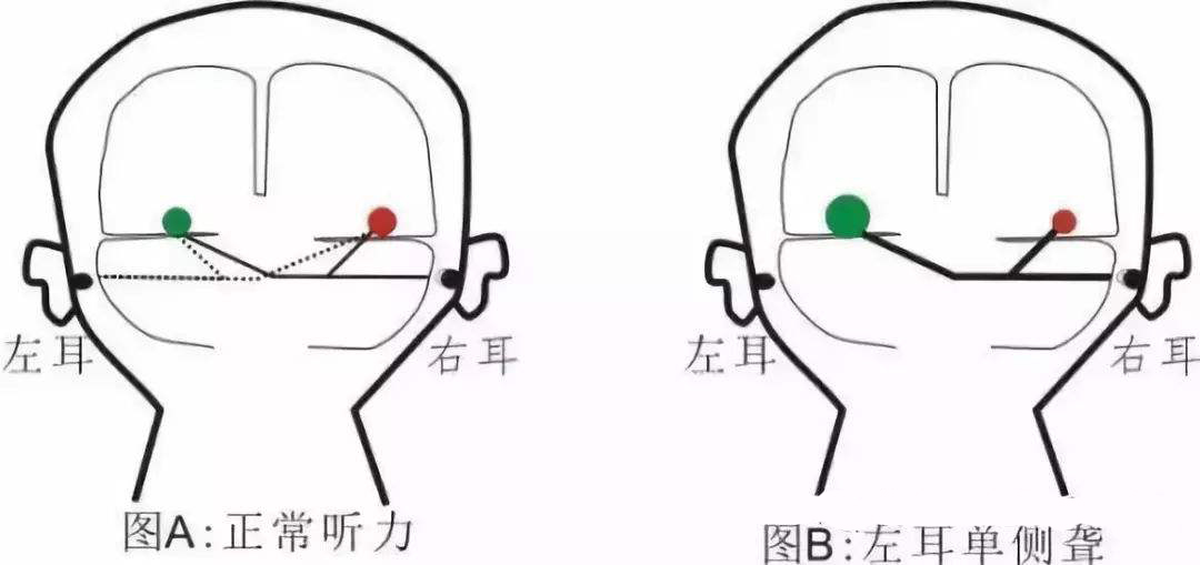 ൺ